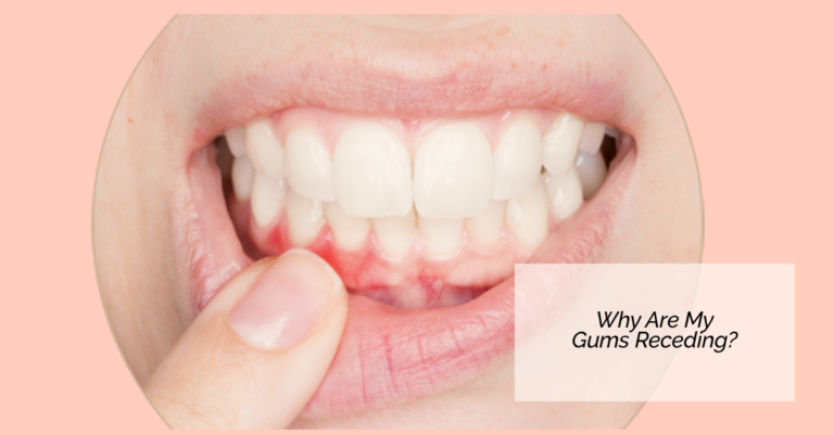 Read more about the article Why Are My Gums Receding?